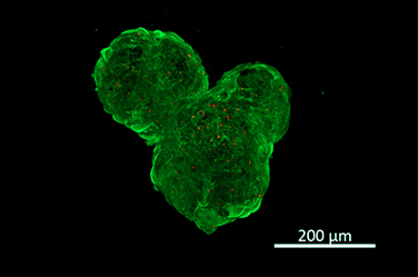 hNSCs, After 1 day, Live/dead assay